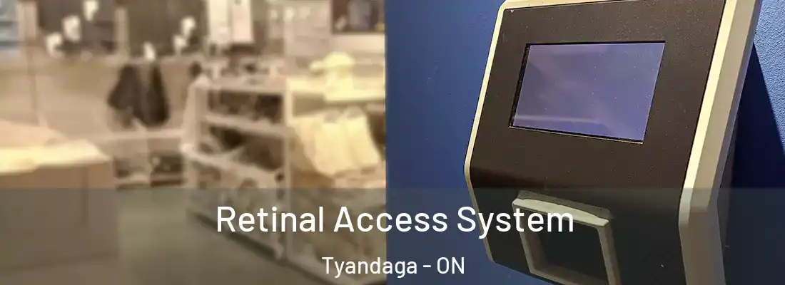  Retinal Access System Tyandaga - ON